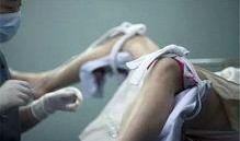 人流手术在线观看,在线观看带你深入了解